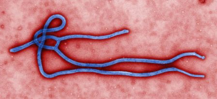 Ebola Virus (c) CynthiaGoldsmith, hochgeladen von MartinH